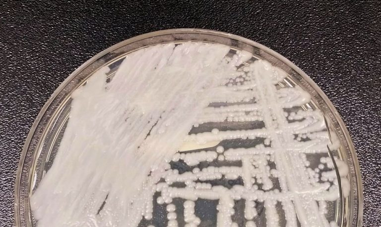 Primeiro caso de superfungo Candida auris